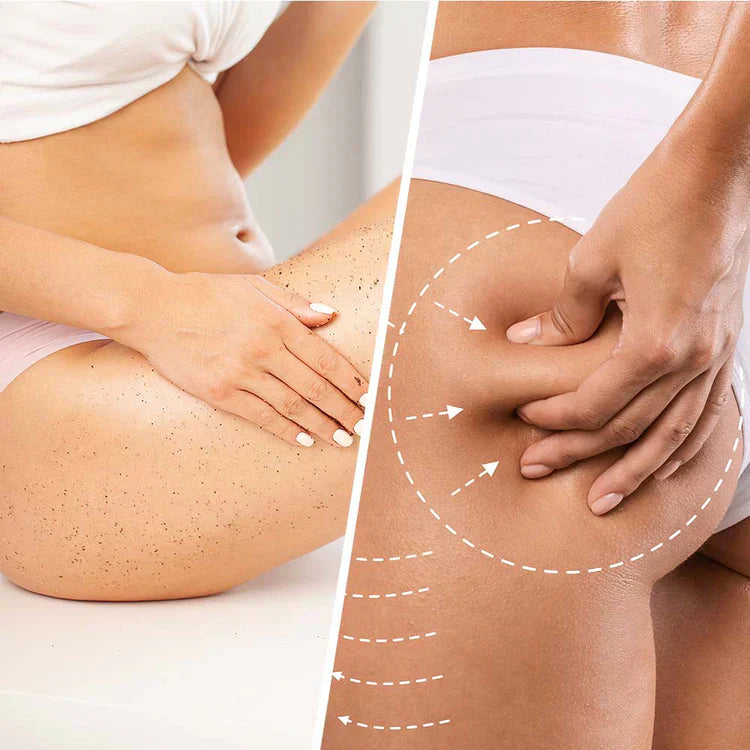 Niacin cellulit elleni bőrradír kókusszal a bőr feszesítésére és kisimítására 250 ml