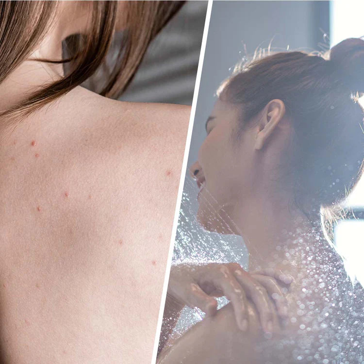 Salicylic scrub with tea tree for skin detoxification 250 ml - Nutra Best Europe