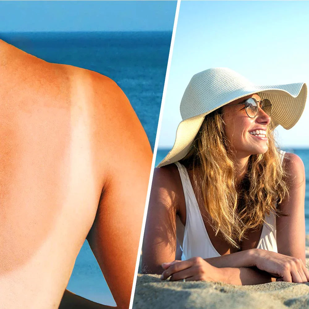 Soothing lotion spray with hyaluronic acid after sun - 200 ml - Nutra Best Europe