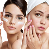 Clear Balance – Moisturizing face cream against pimples and imperfections with niacinamide 50 ml - Nutra Best Europe