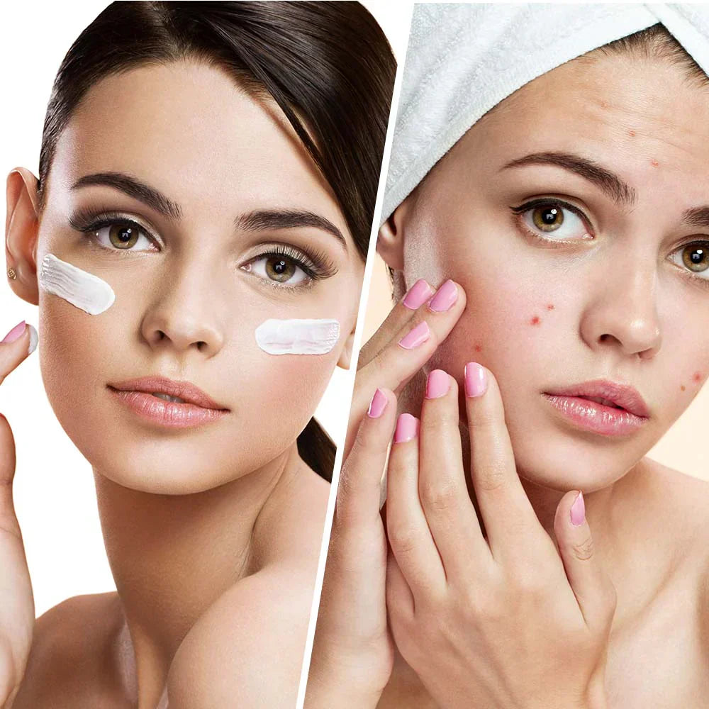 Clear Balance – Hidratáló arckrém pattanások és tökéletlenségek ellen niacinamiddal 50 ml