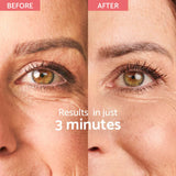 Instant Wrinkle Corrector – wrinkle corrector with instant effect (180 applications) - Nutra Best Europe